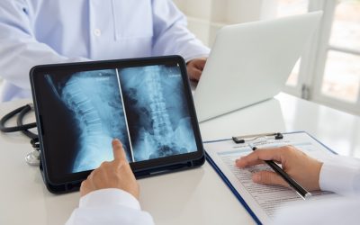 Non-Surgical Herniated Disc Treatment Options