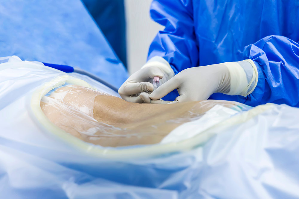 Doctor prepares patient for open spine surgery