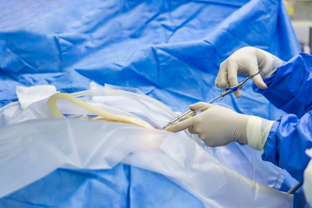 Doctor performs endoscopic spine surgery